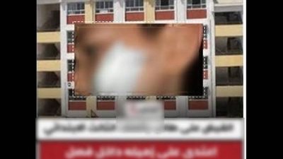 بعد نشر القاهرة 24.. الأمن يكشف تفاصيل مشاجرة مدرسة حلوان: الطالب أصيب بحجر