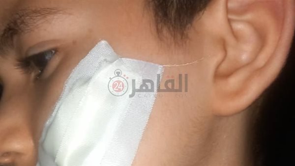 المجني عليه 