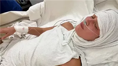 بيلا حديد تخضع لعلاج مكثف في ألمانيا بعد تدهور حالتها بسبب مرض لايم المزمن | ما القصة؟