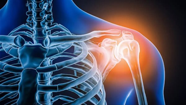 ألم الكتف ـ تعبيرية