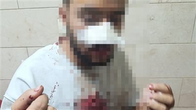 إصابة 3 أشخاص في واقعة تعد بالأسلحة البيضاء بالطالبية