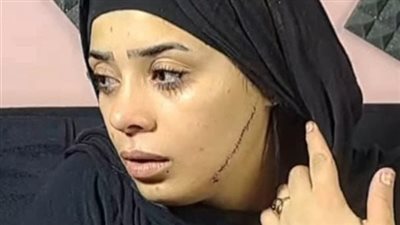 41 غرزة بالوجه.. إحالة المتهمة بتشويه وجه عروس مصر القديمة للجنايات
