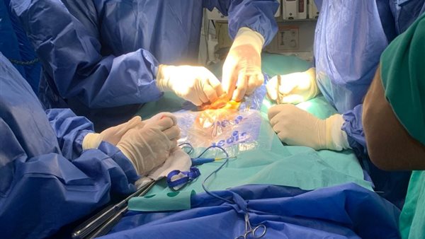 جانب من العملية