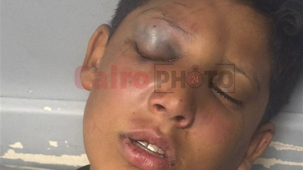 ياسين طفل الخصوص