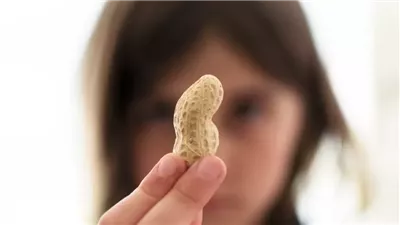 دراسة: حيلة غذائية بسيطة أنقذت 60 ألف طفل من حساسية الفول السوداني خلال 10 سنوات