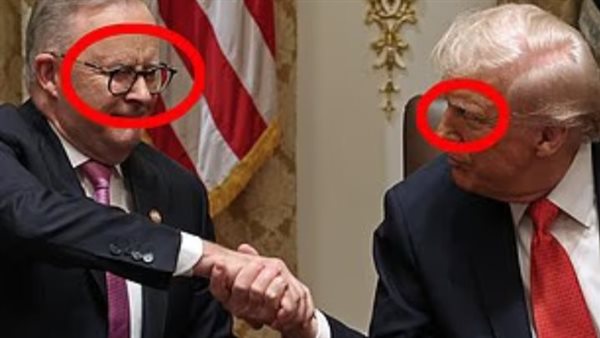 ترامب ـ ألبانيزي