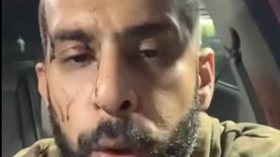 صرف سائق أوبر ضحية الاعتداء من شابين على الطريق الصحراوي بعد الاستماع لأقواله 