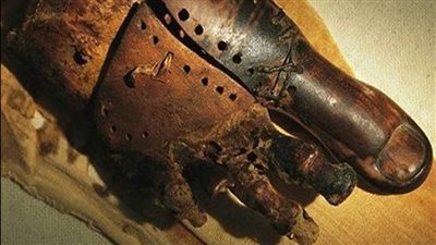 مدير معابد الكرنك السابق: الملك توت عنخ آمون كان يعاني أمراضًا بالعظام.. والمصريون القدماء سبقوا العالم في الأطراف الصناعية