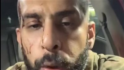 جهات التحقيق تستمع لأقوال سائق أوبر ضحية التعدي من شابين على الطريق الصحراوي