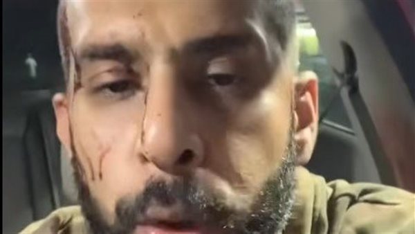 المجني عليه 