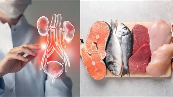 لحوم ـ تعبيرية 