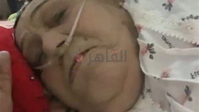 التحقيق مع طاقم تمريض بمستشفى خاص في طنطا بتهمة الاعتداء على مسنة