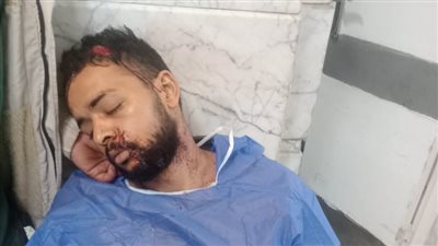 دافع عن خطيبته فضربه بساطور.. تفاصيل إصابة شاب بإصابات خطيرة في شبين القناطر