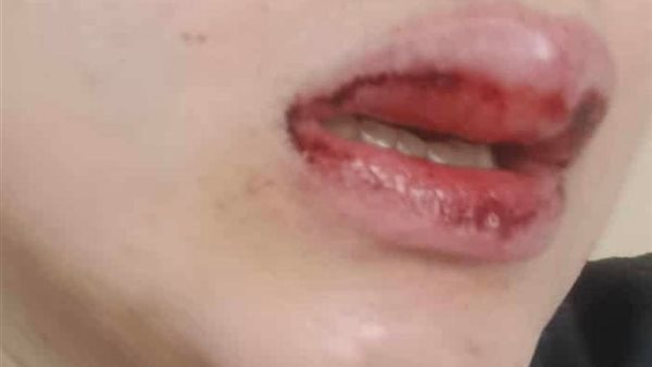 الاعتداء على سيدة