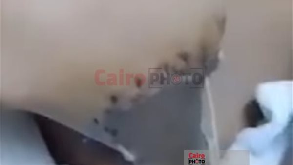 بتر يد طفل ببورسعيد