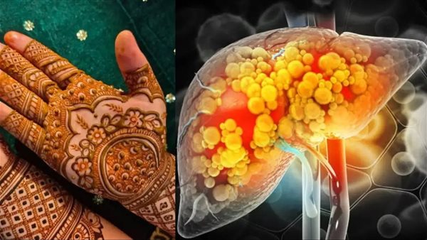 صبغة الحناء