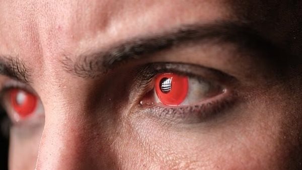 العدسات الملونة ـ