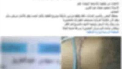 بسبب الجيرة.. مشادة تتحول إلى مشاجرة بالأسلحة البيضاء والأمن يضبط المتهمين بالدقهلية