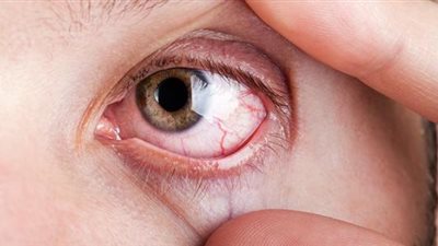 تعرف على داء ويلسون وأبرز أعراضه وكيف يكمن علاجه