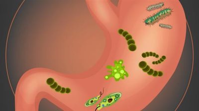 جرثومة المعدة تصيب 50% حول العالم.. استشاري باطنة يوضح أسبابها وعلاجها