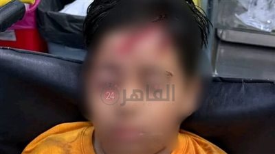 عينه كانت هتروح.. كلب ضال يهاجم صغيرا ووالده في العاشر من رمضان