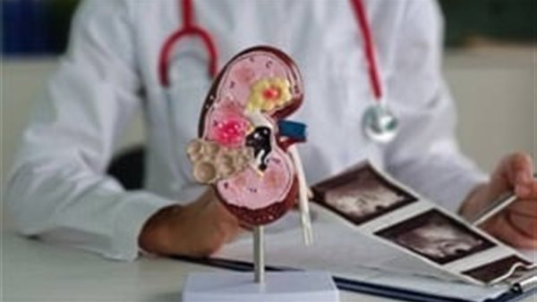 صورة تعبيرية