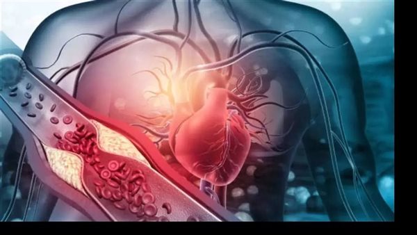 Sorry! Image not available at this time