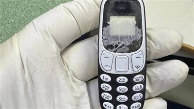 ظل داخله 11 شهرا.. استخراج هاتف محمول من بطن مريض بجامعة المنصورة