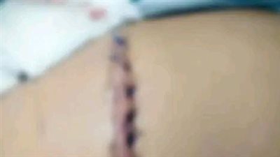 طلاب يعتدون على زميلهم بآلات حادة داخل مدرسة بالزقازيق.. وولي الأمر يطالب بالتحقيق