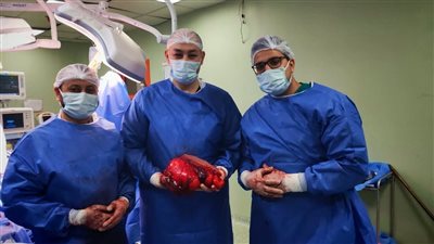 إنجاز طبي.. إزالة ورم سرطاني ضخم مع حماية الأعصاب والأوعية بمستشفى التأمين الصحي ببني سويف