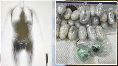 خبأه في أمعائه.. إحباط محاولة مسافر أوروبي تهريب الحشيش إلى الكويت