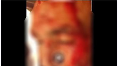 ضبط المتهمين بالتعدي على آخر بسلاح أبيض لرفضه التنازل عن قضية بالدقهلية