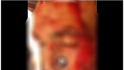 التحقيق مع المتهمين بالتعدي على آخر بسلاح أبيض لرفضه التنازل عن قضية بالدقهلية