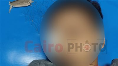معلمة ضربته بالعصا.. ننشر صور تلميذ فقد عينه بعد التعدي عليه داخل مدرسة في قنا