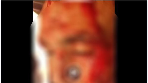 جانب من الواقعة 