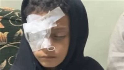 ننشر التقرير الطبي لتلميذ فقد عينه على يد معلمة في مدرسة الألومنيوم للغات بقنا