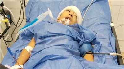 تفاصيل الحالة الصحية لـ الصغير ياسين بعد سقوطه من الطابق الخامس ببورسعيد