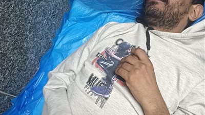 المريض بورم في المخ    