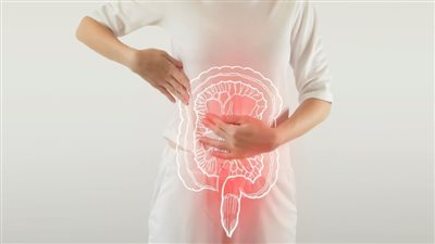 متلازمة القولون العصبي     