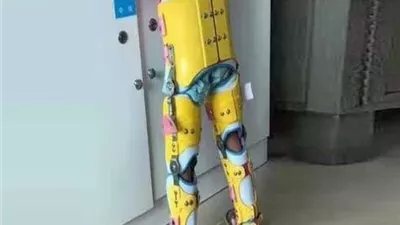 التعليم العالي تدرس إنشاء أول مستشفى جامعي متخصص في الأطراف الصناعية والأجهزة التقويمية | خاص 