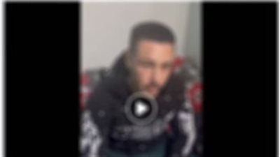 الزباين عاملين إزعاج.. أسرة تعتدي على صاحب محل بمادة حارقة بكرداسة 