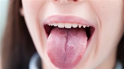 دراسة تحدد مشروبا يزيد من خطر الإصابة بسرطان الفم بنسبة 50%