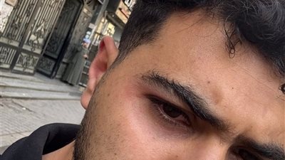 ضربني وقطع شنطتي.. شاب يزعم تعرضه للاعتداء من سائق موتوسيكل انتحل صفة كابتن لتطبيق نقل ذكي 