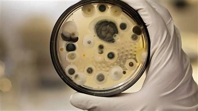 عدوى المبيضات الأذنية    