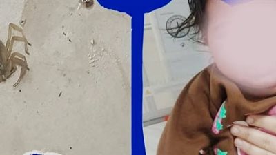  إنقاذ طفلة بعد لدغها واكتشاف عقرب سام داخل ملابسها بمستشفى جهينة المركزي بسوهاج