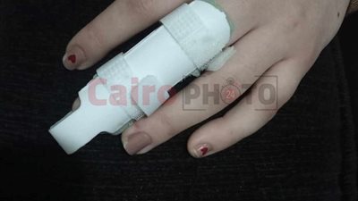 هجوم للكلاب الضالة على طالبة بمطروح وإصابتها ونقلها للمستشفى