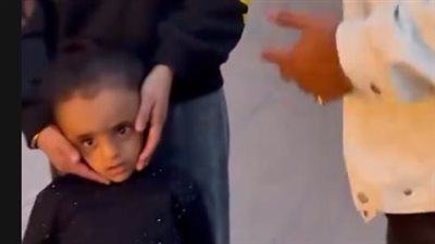 سيدة تستغيث لعلاج ابنتها بعد تعرضها للتنمر بسبب مرض بالمخ: بلف بيها ومش قادرة أعالجها