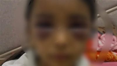 استغلت غيابه.. حبس سيدة بتهمة تعذيب وضرب صغيرتين من أبناء زوجها بالشرقية