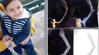 والدة صغير تناشد بالتدخل العاجل لإنقاذه من خطر فشل عضلة القلب: جلسة علاج أولى خلال 3 أسابيع 