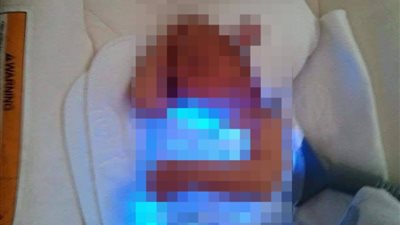 العملية بمليون جنيه.. والد رضيعة يستغيث لإنقاذها من مرض كبدي نادر